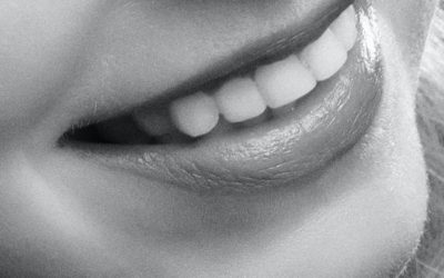 Caries dental