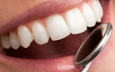 Importancia de la revisión dental anual