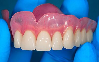 Cómo limpiar prótesis dentales