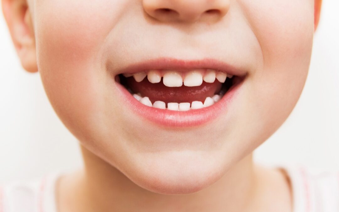 ¿Por qué son tan importantes los dientes de leche?
