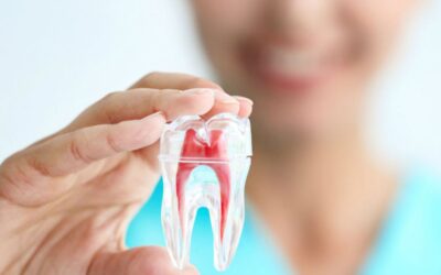 Todo lo que debes saber sobre la endodoncia