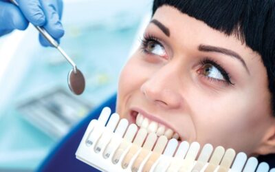 Opciones para blanquear tus dientes y presumir de una sonrisa radiante