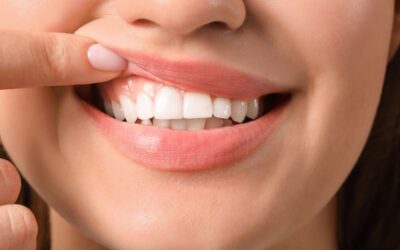 Periodoncia: Tratamiento de la gingivitis y periodontitis