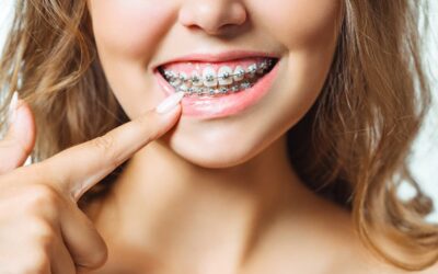 ¿Es posible corregir los dientes desalineados con ortodoncia en adultos?