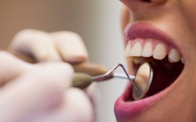 Odontología conservadora: mantén tus dientes en óptimo estado
