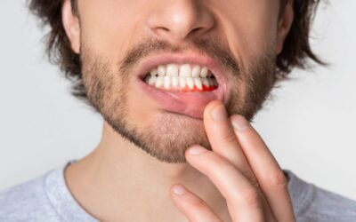 Periodoncia: cómo detectar y prevenir problemas de encías